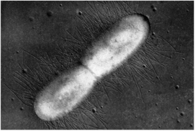 Фимбрии у клетки Escherichia coli (электронная микрофотография).