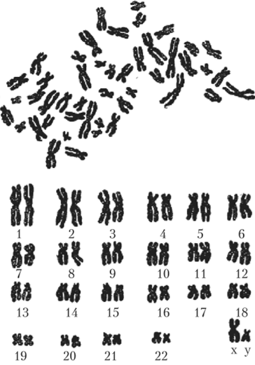 Хромосомный набор человека.