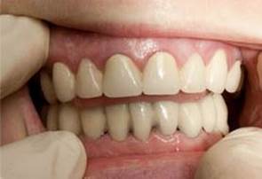 Полезные функции. Характеристика временных зубных протезов.