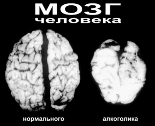 Мозг и нервная система.